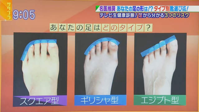 推特話題《從腳型選適合的鞋子》你的腳趾是羅馬、希臘還是埃及型? 推特話題《從腳型選適合的鞋子》你的腳趾是羅馬、希臘還是埃及型?