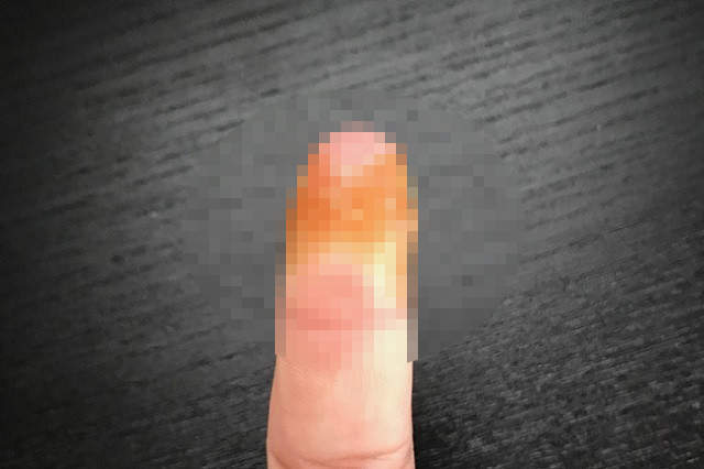 《指尖的OK繃貼法》難固定的部位也能讓OK繃完全貼合啦~ 《指尖的OK繃貼法》難固定的部位也能讓OK繃完全貼合啦~