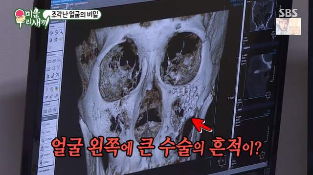 小時候跟別人打架《結果埋藏10幾年的秘密被發現》連老媽都不知道....