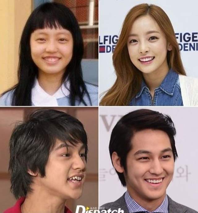 不要再說他們有整型啦《藝人零整形換顏術》關鍵就是用時間換自然美