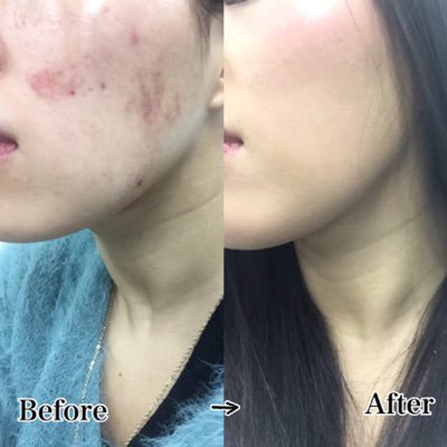 女子摔角選手《夏すみれ的鐵壁畫妝術》被揍也要美美的…… 女子摔角選手《夏すみれ的鐵壁畫妝術》被揍也要美美的……