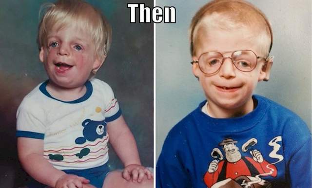  勵志《因遺傳疾病被拋棄的孩子》即使爸媽拒絕見面也沒被擊倒