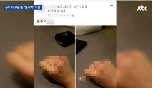 校園暴力再現《打完人之後上傳打到受傷的拳頭》還得意洋洋的自拍 校園暴力再現《打完人之後上傳打到受傷的拳頭》還得意洋洋的自拍