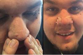 【閱覽注意】《異常療癒的清粉刺畫面》這也算是爆漿級享受吧...... 【閱覽注意】《異常療癒的清粉刺畫面》這也算是爆漿級享受吧......