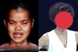 《Let Me In Thailand》泰國整形節目把女孩改頭換面實在有夠神 《Let Me In Thailand》泰國整形節目把女孩改頭換面實在有夠神