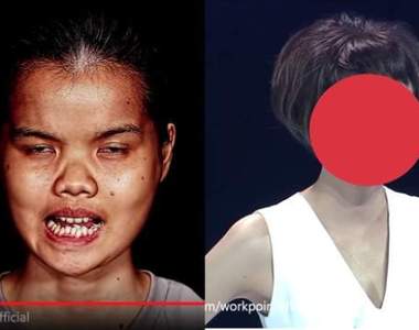 《Let Me In Thailand》泰國整形節目把女孩改頭換面實在有夠神 《Let Me In Thailand》泰國整形節目把女孩改頭換面實在有夠神