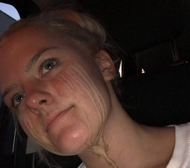 《上助曬劑後不能哭》哭出來的下場就是這樣...... 《上助曬劑後不能哭》哭出來的下場就是這樣......