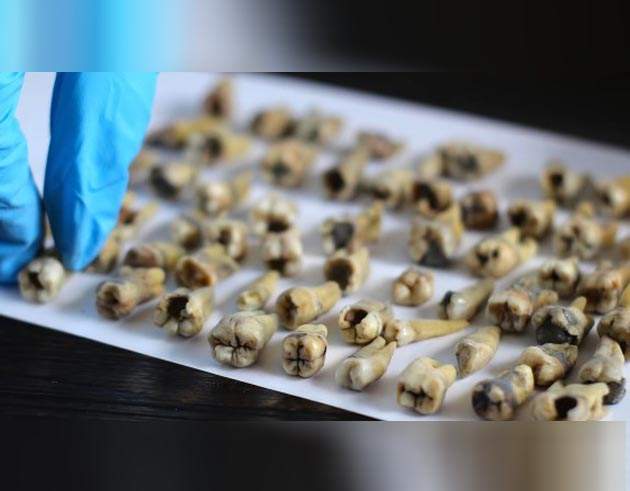 《從牆裡挖出1000顆人類牙齒》這可能是今年最不缺鈣的毛骨悚然新發現 《從牆裡挖出1000顆人類牙齒》這可能是今年最不缺鈣的毛骨悚然新發現