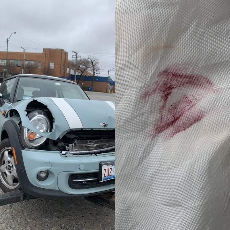 根本用生命在安利《車禍口紅照》這場車禍讓一支口紅和一位女孩紅了