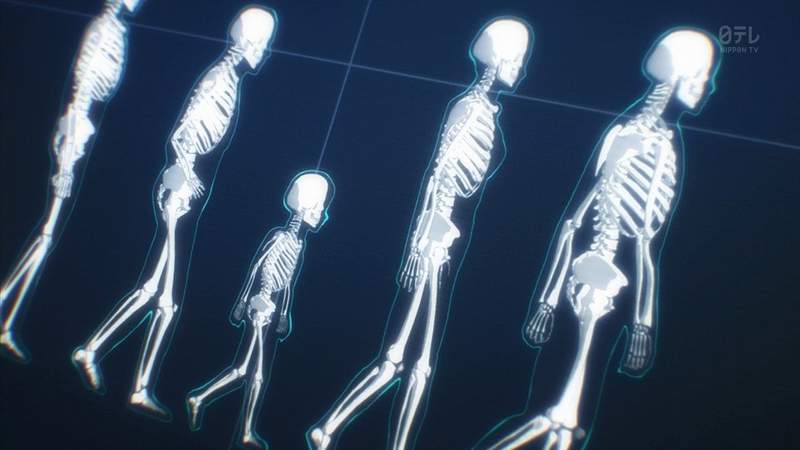 《帶著指彩照X光的結果》一照驚覺原來自己手指骨頭那麼時尚ww 《帶著指彩照X光的結果》一照驚覺原來自己手指骨頭那麼時尚ww