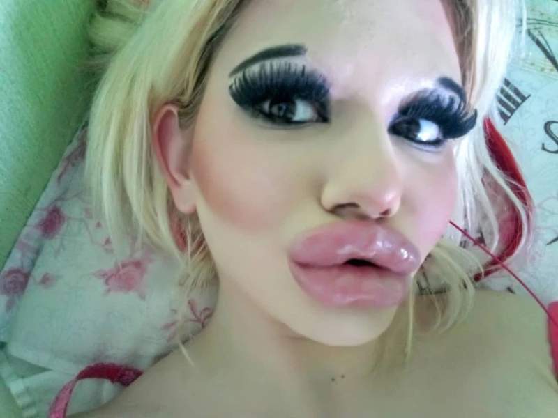 迷上豐唇《把自己整成香腸嘴》嘴唇厚到跟五官不成比也太詭異了......