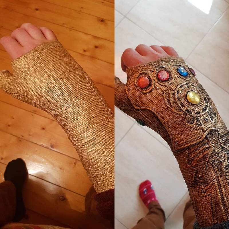 網友把石膏變成《無限手套》既然都受傷了不如自娛娛人一下嘛~ 網友把石膏變成《無限手套》既然都受傷了不如自娛娛人一下嘛~