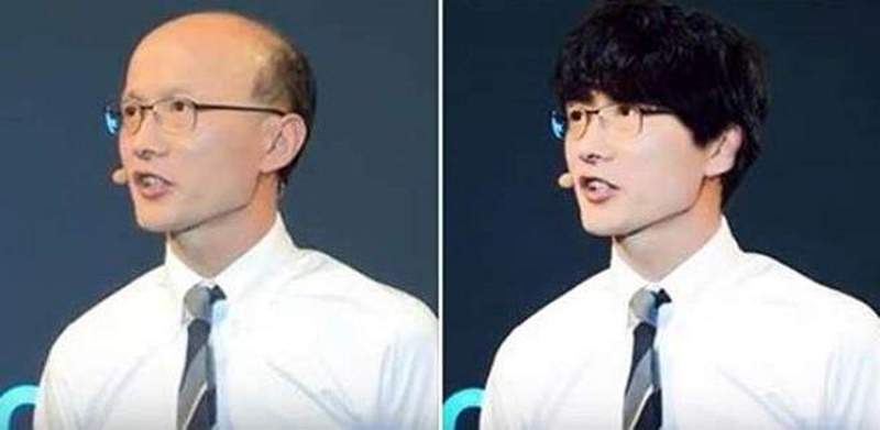 《男友禿頭讓女友想分手》是女友太現實還是有些不得不考慮的因素？