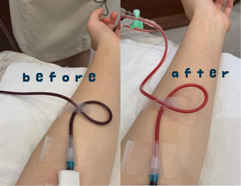 日本藝人瘋《臭氧血療法》號稱能淨化血液的美容法，遭網友批根本義務教育失敗...