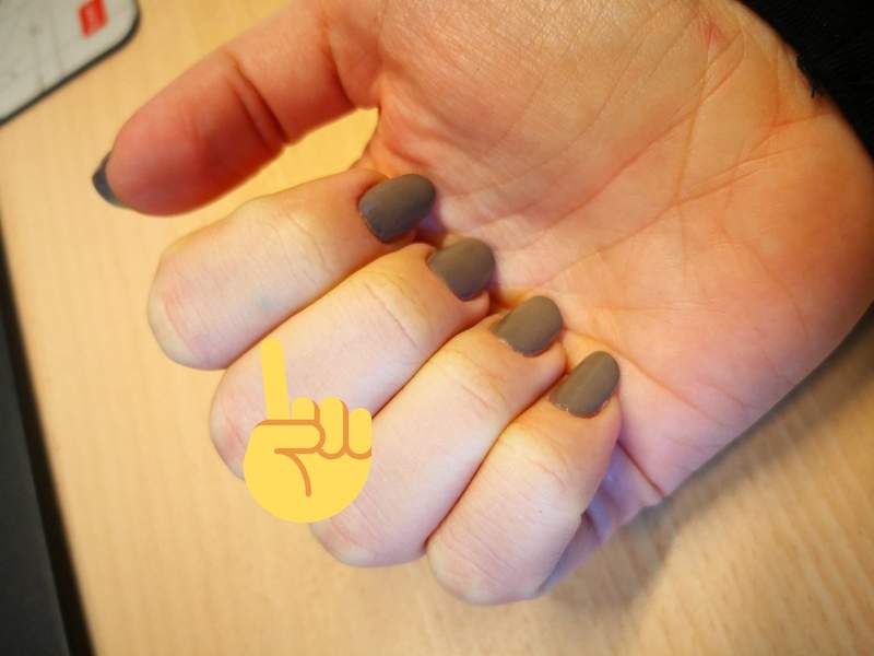 《筆芯插進手裡》上網問問有沒有類似的人結果釣出一堆網友XD 《筆芯插進手裡》上網問問有沒有類似的人結果釣出一堆網友XD