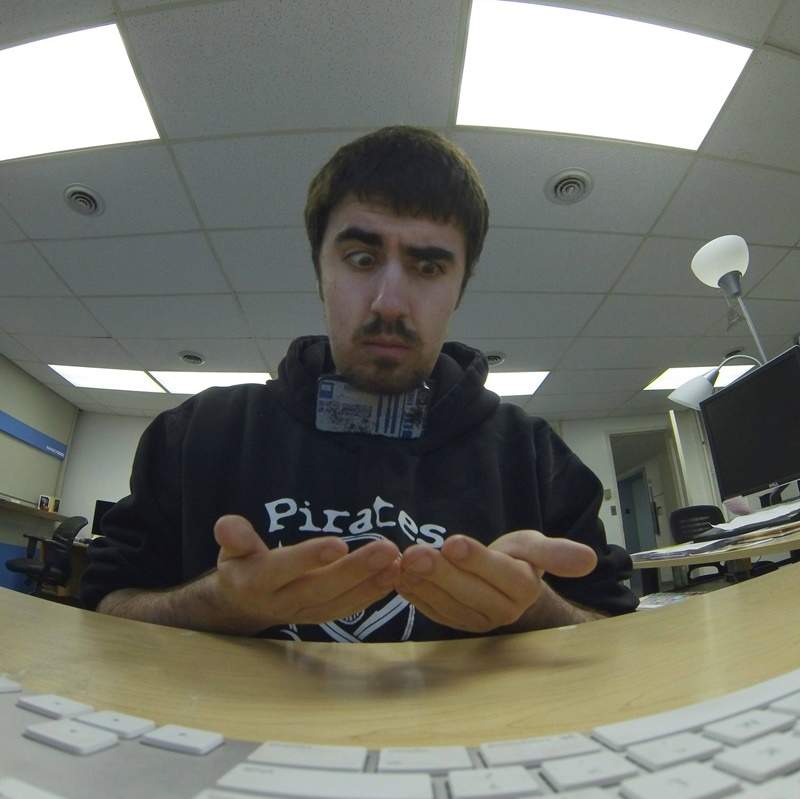 網友曬《關節攣縮症照》結果評論大歪樓 該說這就是網路生態嗎w 網友曬《關節攣縮症照》結果評論大歪樓 該說這就是網路生態嗎w