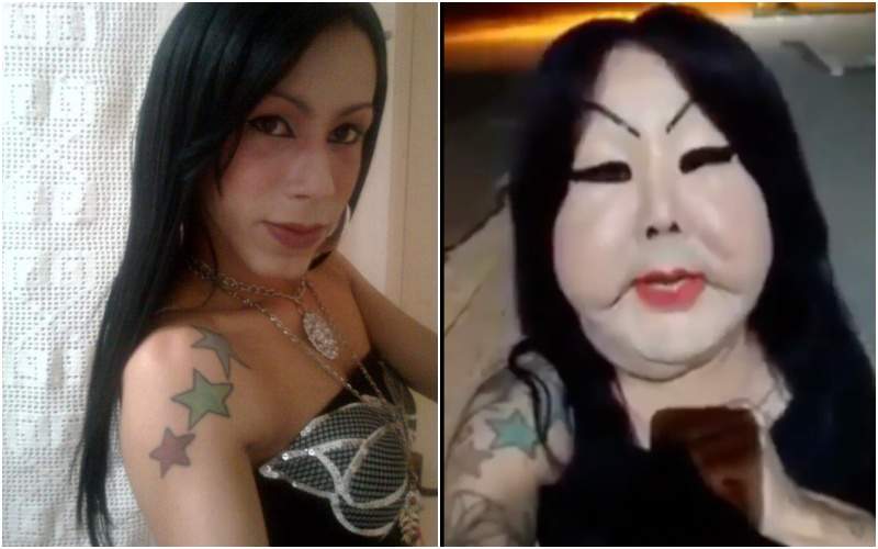 《巴西女整形失敗》募款救臉 結局出爐全網「三條線」 讓她淚崩做一件事 《巴西女整形失敗》募款救臉 結局出爐全網「三條線」 讓她淚崩做一件事