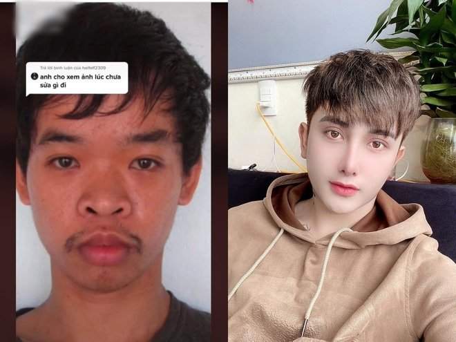 越南醜男求職失敗 整形成《韓系歐巴》帥到連父母都認不得 越南醜男求職失敗 整形成《韓系歐巴》帥到連父母都認不得