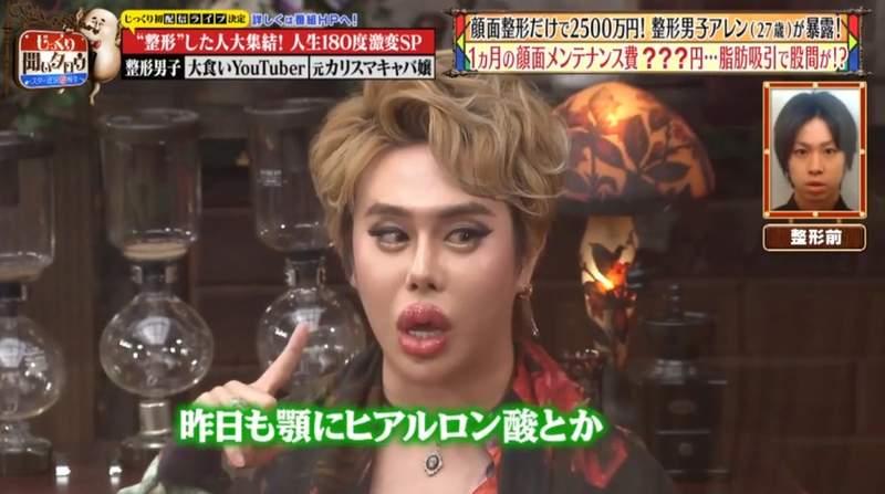 日本整形鼻祖《千萬整形男艾倫》即便剩下一位金主還是要繼續整下去 日本整形鼻祖《千萬整形男艾倫》即便剩下一位金主還是要繼續整下去